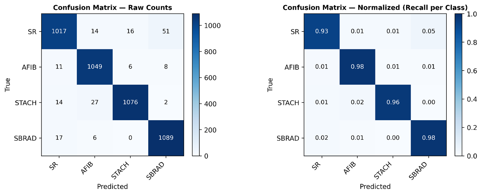 Matrices de confusión del modelo en conteos absolutos y normalizadas por clase